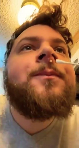 CYST PIMPLE IN BETWEEN NOSE AND UPPER LIP!