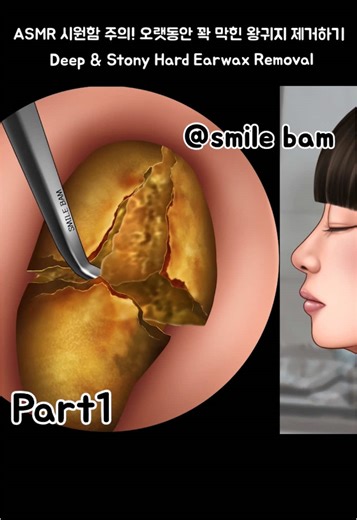 #smilebam #애니메이션 #케어 #care #쥐젖 #asmr #soonent #satisfying #earcleaning #귀청소