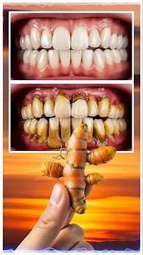 REMOVE TARTAR in 2 Mins! 🦷 NO DENTIST! 🌿 (Turmeric & Olive Oil Hack)