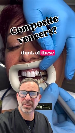 Veneers By Dr. Andrew Hall on Instagram: "Composite veneers are made of a tooth-colored resin (the same material used for fillings) that is sculpted directly onto your teeth. The Pros • Cost-Effective: They are significantly more affordable than porcelain veneers, often costing about half the price. • Quick & Non-Invasive: Usually completed in just one visit, they often require little to no removal of your natural tooth enamel. The Cons • Durability: They are more prone to chipping and typically