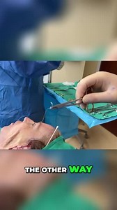 Quill Sutures_ The Secrets of Contour Threads Explained