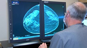 FDA clears way for Cleveland Clinic’s groundbreaking breast cancer vaccine