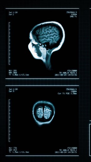 You'll be SHOCKED when you realize how much money you’re leaving on the table 👇 Even if your accident seemed minor – or if you were just a passenger – you could still qualify for 5 or 6 figure settlements. And guess what? You can find out if your accident could qualify for a bigger payout by using the compensation calculator below. ***The best part is that if you qualify for additional compensation, you don't have to pay or do anything to receive your money. Settlement specialists will provide 