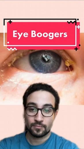 Eye Doctor Mike on TikTok