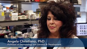 Cure for baldness? Scientists believe so by blocking enzymes