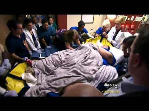'Half-Ton Killer' Reveals 800-Pound Weight Loss