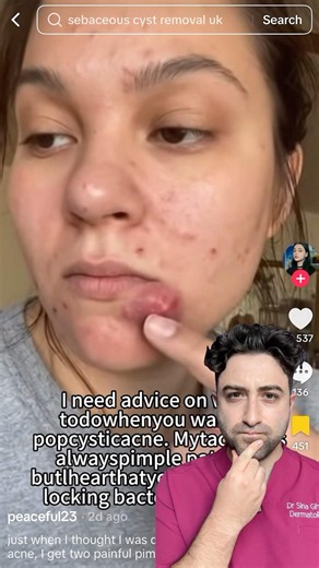 Why your pimple patch isn’t working…