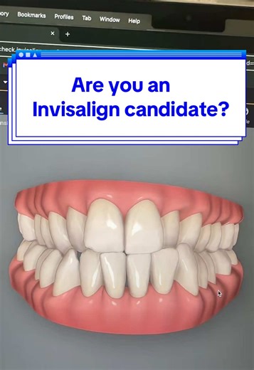 Invisalign Treatments for Perfect Smiles in 2026