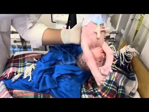Newborn Baby After Birth | Initial Care | Temperature Check | Vitamin K Injection | Neonatal Care