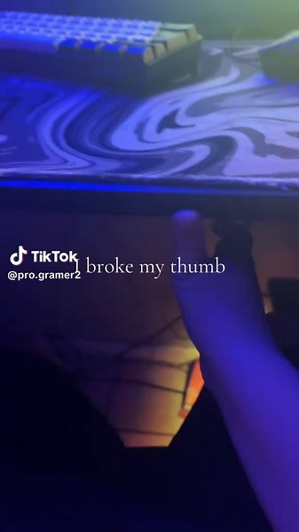 Como saber si tienes una fractura en el dedo