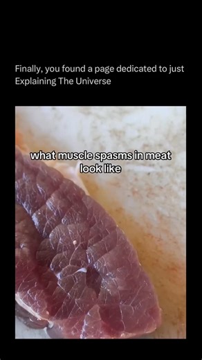 Explaining The Universe on Instagram: "Follow (us) @ExplainingTheUniverse to learn something NEW every day 🧠 A muscle spasm is an involuntary contraction of a muscle that happens suddenly and can feel like a cramp, twitch, or tight knot. It’s usually caused by factors like dehydration, fatigue, nerve irritation, or imbalances in electrolytes such as potassium, calcium, or magnesium. Spasms can last just a few seconds or several minutes, and while often harmless, they can be painful and disrupt 