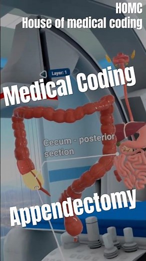 Appendectomy Surgical Procedure | CPT 44950 Learning