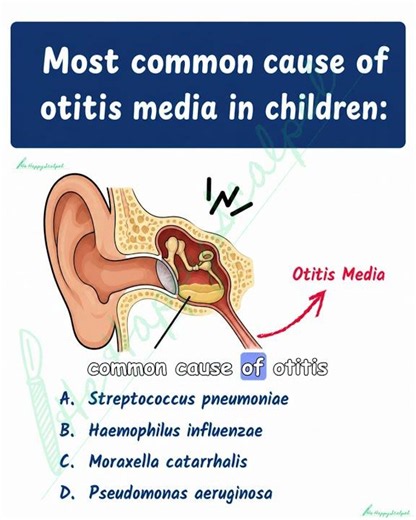 Most common cause of otitis media in children - THE HAPPY SCALPEL