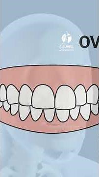 The Difference Between Overbite and Underbite