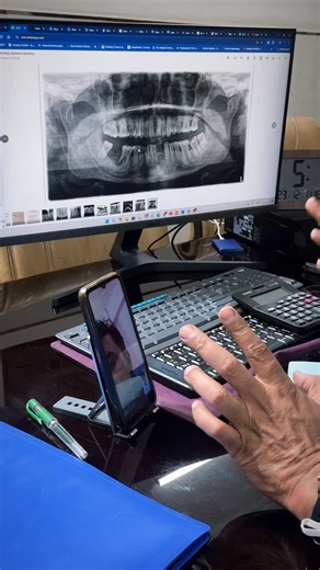 Online Dental Consultation for patients in Mauritius by Dr Rajat Sachdeva, Delhi. This video explains how patients from Mauritius can plan dental treatment in Delhi through professional teleconsultation before travelling to India. Dr Rajat Sachdeva provides online dental consultation for: Dental Implants Full Mouth Rehabilitation Smile Makeover Jaw Pain, TMJ & complex dental problems Through online consultation, patients can understand their dental condition, discuss treatment options, timelines