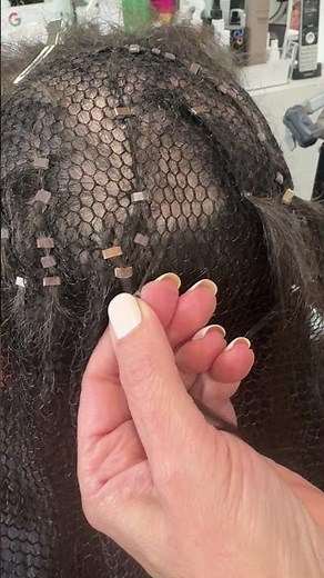 Mesh Integration Hair Loss System for Trichotillomania