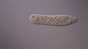 Fast moving amoeba at 400x magnification | Micro Photography