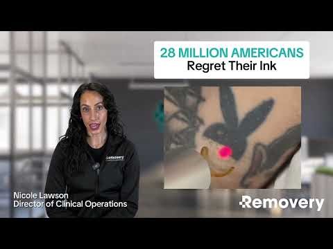 Tattoo Regret: Why 28 Million Tattooed Americans Want Tattoo Removal