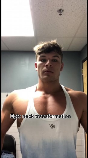 3 Years Later: Epic Neck Transformation Before and After