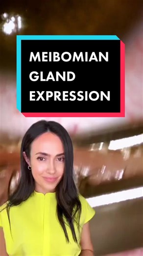 Meibomian Gland Expression for Dry Eye Treatment