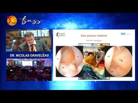 Diffusion en direct de Bechir Abassi