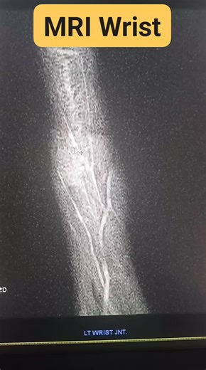 #MRI #wristjoint #mriwrist #mriscan #mridti | CT Scan and MRI study