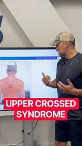Upper Crossed Syndrome | Learn how to fix it | SUF Where Great #personaltrainer are made