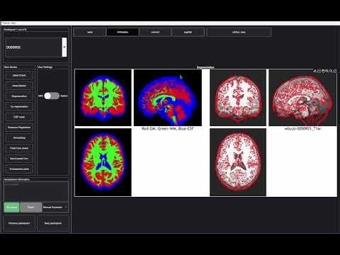 WhiFuN Quality Control Viewer (QCviewer)