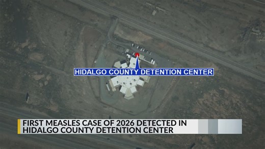 Inmate at Hidalgo County Detention Center tests positive for measles
