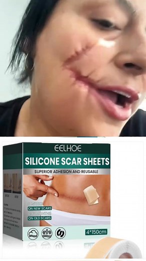 101 reactions · 20 comments |  Say Goodbye to Scars – Restore Your...