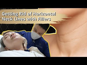 Getting Rid of Horizontal Neck Lines with Dermal Fillers