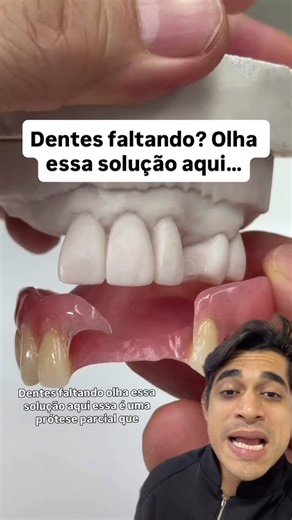 Odontologia Descomplicada 🦷 on Instagram: "Muita gente acha que perdeu um dente e a única solução é implante… mas nem sempre 👀 Essa é uma prótese parcial removível, uma opção moderna e personalizada para repor dentes perdidos, devolvendo estética, função e qualidade de vida. 👉 O que é? É uma prótese feita sob medida que se apoia nos dentes naturais e na gengiva, preenchendo os espaços onde faltam dentes. ✨ Vantagens da prótese parcial: ✔️ Melhora a mastigação ✔️ Ajuda na fala ✔️ Devolve o sor