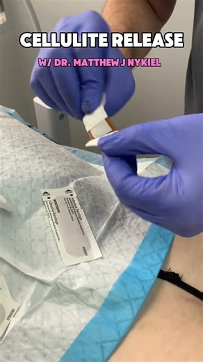 Did you know you can get rid of Cellulite? | Dr. Matthew J Nykiel