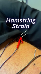 1.4K views |  Hamstring Strain Recovery A hamstring strain can...