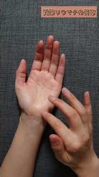 The pain of a single thumb renders my entire left hand useless… This is the reality of living wit...