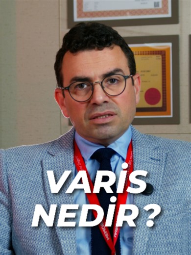 Varis Nedir ve Neden Olur? Varis, özellikle uzun süre ayakta duran veya oturan kişileri yakından tehdit eden oldukça yaygın ve önemli bir damar hastalığıdır. Peki, genellikle sadece estetik bir sorun sanılan bu hastalık aslında nasıl oluşur ve ne gibi gizli riskler barındırır? ✨ Nasıl Oluşur? ✔️ Bacaklardaki kanı kalbe taşıyan toplardamarlarımızda, kanın aşağıya geri kaçmasını önleyen tek yönlü kapakçıklar bulunur. ✔️ Bu kapakçıkların yapısı bozulduğunda kan geriye (aşağıya) kaçar. ✔️ Artan bası
