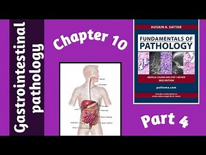 Pathoma Lectures || Chapter 10 GIT Pathology (part 4)