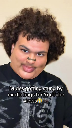 Stung by a Wasp: An Unfunny Encounter with Nature