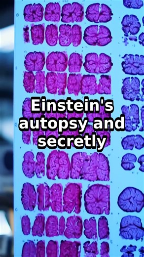 Einstein's Brain Was STOLEN and Kept in a Jar 🧠