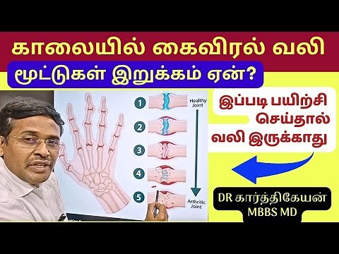 5 Hand Pain & Finger Pain Relief Exercise Treatments | osteoarthritis | Ask Doctor Karthikeyan