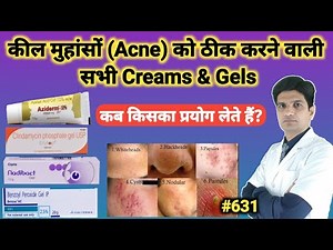 Acne treatment cream | Acne treatment | Acne cream review