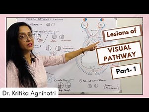 Visual Pathway : Lesions | Part 1