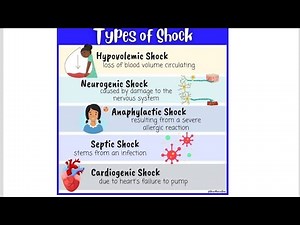 Mnemonics to remember Types of Shock; Hypovolemic, Cardiogenic, Septic, Anaphylactic, Neurogenic