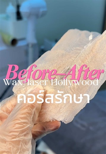 Hollywood Wax Laser: บริการเลเซอร์กำจัดขนในภูเก็ต