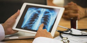 Cancer breakthrough: Daily pill which can DOUBLE survival time of lung cancer patients to be made available on NHS