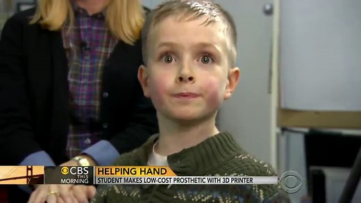 Student makes low-cost prosthetic with 3D printer
