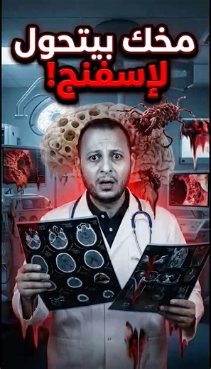 سر البريونات: كابوس بيولوجي يحول مخك إلى إسفنج 💀