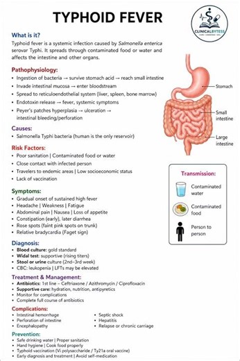 Typhoid fever full explanation with treatment and diagnosis