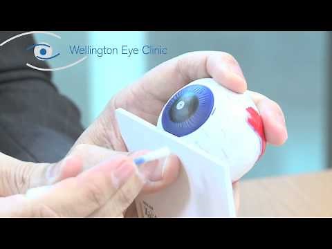 Meibomian Gland Expression WM