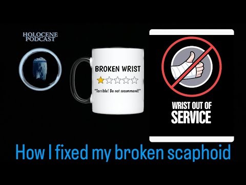 Doctors Said I Needed Surgery… I Healed My Scaphoid Naturally